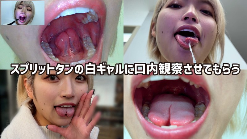 街角で声をかけて口内観察させてもらう 美容部員 はるのちゃんh_1651nko0500001