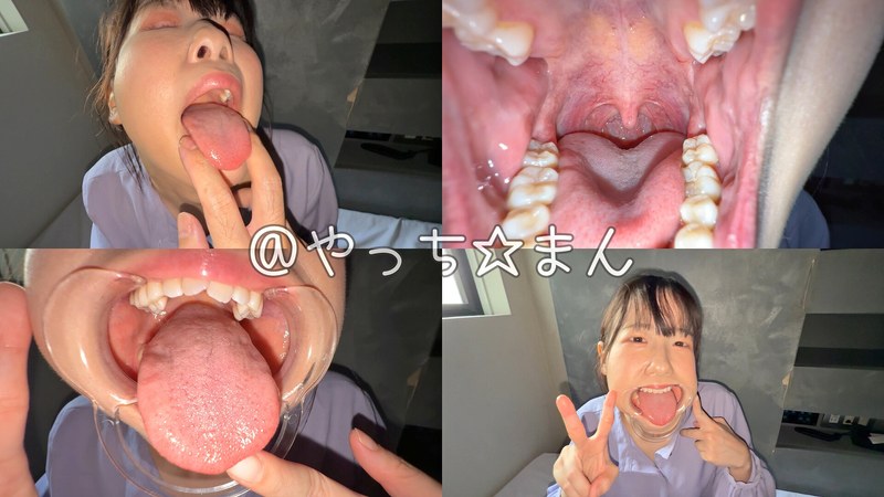 【個人撮影】谷田かりな 開口器で口内観察デカ舌を要チェックh_1651y00304