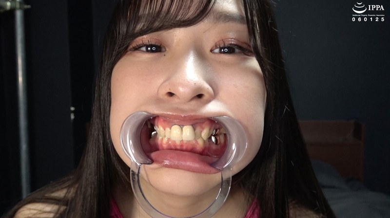 【歯＆口腔】人気女優 朝比ゆのチャンの歯＆口腔＆のどちんこ観察と小魚舐め！h_1416ad01843