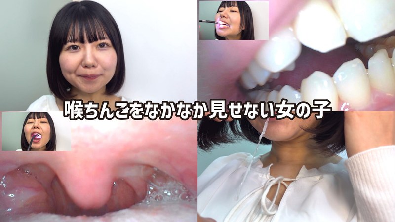 [素人]街角で声をかけて口内観察させてもらう テレビ局AD みゆりちゃんh_1651nko0600006